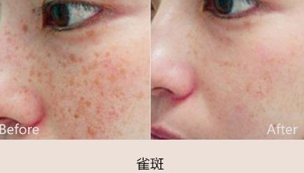 鎮(zhèn)江哪家醫(yī)院做雙眼皮手術(shù)好？詳細(xì)比較分析，推薦最佳項(xiàng)