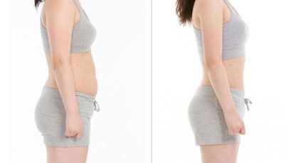 蘇州埋線雙眼皮效果如何？哪家醫(yī)療機(jī)構(gòu)值得選擇？