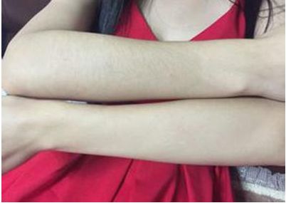 沈陽(yáng)雙眼皮修復(fù)哪家好專家推薦修復(fù)雙眼皮技術(shù)高超牌醫(yī)院