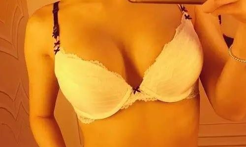 阿雅整容了嗎？揭秘她的美麗變身秘籍！