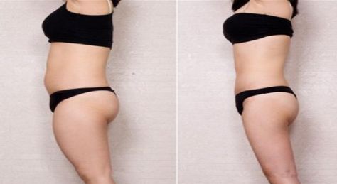 深圳祛痘坑醫(yī)院哪家好？揭秘市區(qū)五家痘疤修復(fù)專(zhuān)科中心