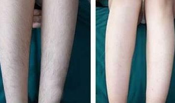 上海下巴整容醫(yī)院排名及口碑大揭秘