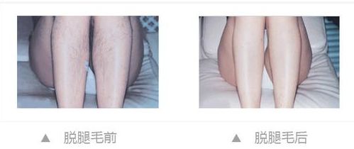 揭秘江陰激光祛斑哪家醫(yī)院好，專家解答告訴你最靠譜的醫(yī)院