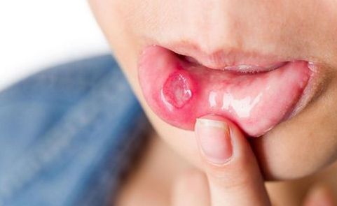 杭州哪家醫(yī)院治附耳好？附耳就醫(yī)攻略精選！