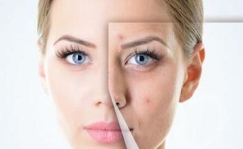 德州割包皮醫(yī)院哪家好？選擇正規(guī)醫(yī)院，了解手術(shù)流程和費(fèi)用