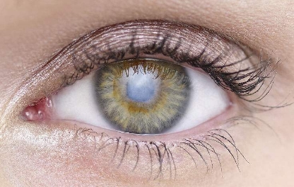 李菲兒近期是否進行整容手術(shù)？