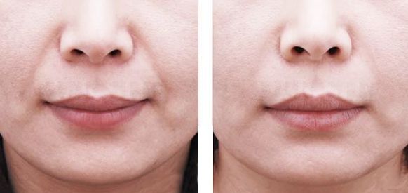 上海美容整形醫(yī)院排名2023年哪家最靠譜？