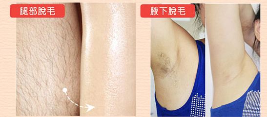 【2023最新】哈爾濱哪家祛斑效果好？打造雪白肌膚推薦服務(wù)匯總