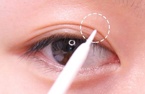 全新陣容亮相！2023上海植發(fā)醫(yī)院微針技術(shù)穩(wěn)居領(lǐng)先！