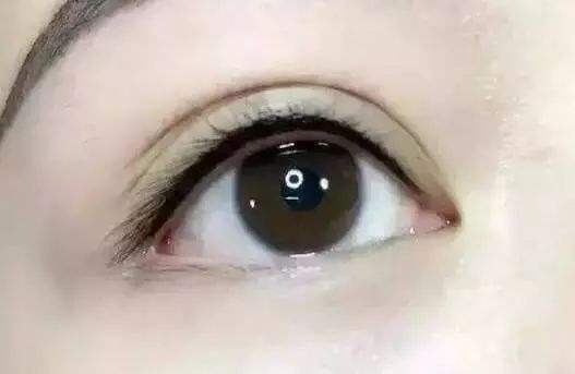 超聲吸脂減肥手術，能否持久塑身？減肥后需注意哪些事項？