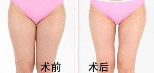 嘉興哪家醫(yī)院外科專家團(tuán)隊(duì)強(qiáng)大值得推薦,看外科嘉興哪家醫(yī)院好