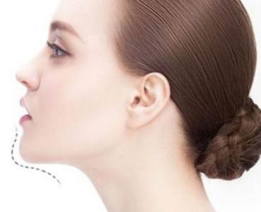 重慶唇紋去除手術(shù)醫(yī)院優(yōu)質(zhì)推薦！2023年性?xún)r(jià)比高的有哪些？享有聲譽(yù)的10家整形醫(yī)院綜合解析！