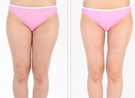 南京市優(yōu)質(zhì)皮膚美容醫(yī)院推薦，治療斑點(diǎn)效果顯著