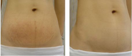 沈陽眼部熱瑪吉哪家好？權(quán)威醫(yī)美機(jī)構(gòu)排行榜