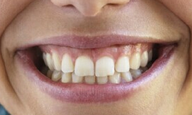 哈爾濱眼袋整形熱門醫(yī)院都有哪些？眼袋問題應(yīng)該去哪家醫(yī)院解決？