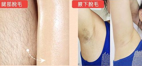 廈門副乳哪家醫(yī)院好？專家推薦最受用戶青睞的廈門醫(yī)院