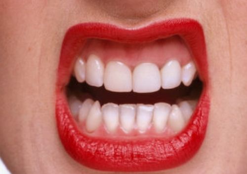 上海磨顴骨哪家醫(yī)院好？揭秘2023年最受歡迎的磨顴骨醫(yī)療機(jī)構(gòu)