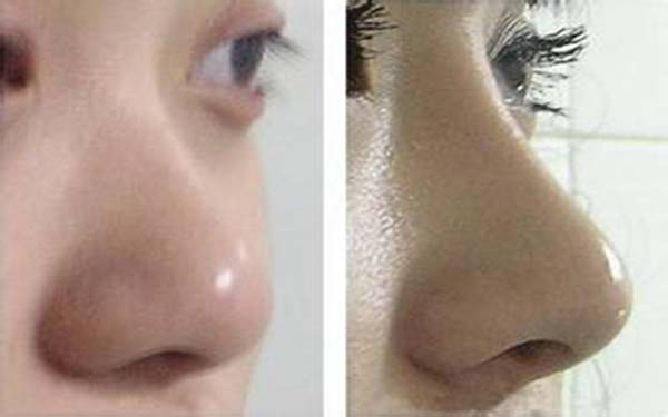 疫情期間釋放贅肉還不嘗試這四個(gè)劉畊宏教的瘦肚子動(dòng)作？