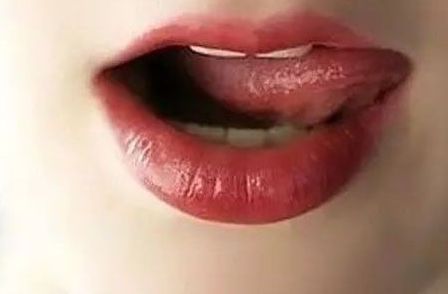 武漢哪家醫(yī)院能有效去除皮膚斑點？