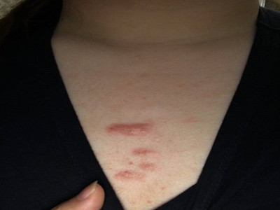 惠州中京醫(yī)院真的靠譜嗎？是一家值得信賴的整形醫(yī)院嗎？