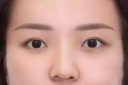 2023年鄭州臉部皺紋修復(fù)醫(yī)院綜合排行榜大揭曉，你知道都有哪些嗎？