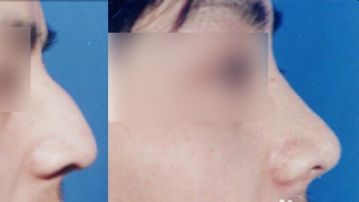 南京醫(yī)院熱瑪吉推薦，10家權(quán)威醫(yī)療機(jī)構(gòu)抗衰技術(shù)PK，勝算高！