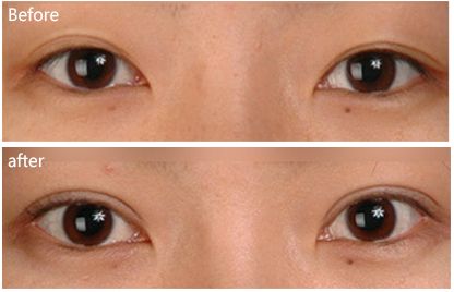 徐州市哪家醫(yī)院祛痘效果好？排名前列的徐州市專業(yè)祛痘醫(yī)院有哪些？