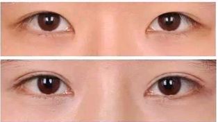 天津整容醫(yī)院推薦-專(zhuān)業(yè)技術(shù)與良好口碑，靠譜名單分享