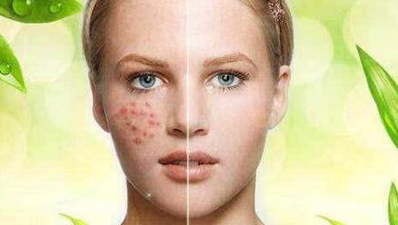 “冷光子嫩膚儀——真的能有效改善肌膚問題嗎？”