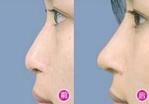 深圳哪家醫(yī)院是拉皮專家？專業(yè)的整形醫(yī)院名單！