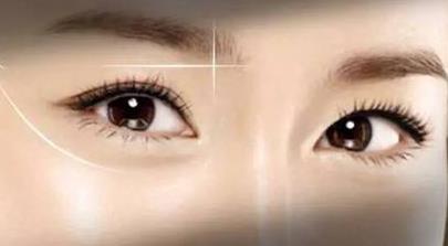 南昌哪家醫(yī)院的開眼角全切雙眼皮效果好？2023年排名前10的南昌醫(yī)療美容醫(yī)院推薦