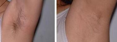 南寧微整正規(guī)醫(yī)院哪家好？揭秘南寧當(dāng)?shù)乜诒詈玫奈⒄吾t(yī)院！