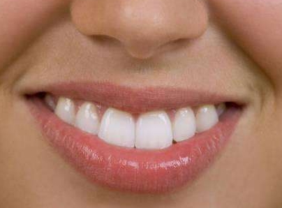 環(huán)形吸脂操作究竟有效嗎？如何實現(xiàn)手臂360°塑形術(shù)？