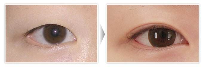 如何在湛江享受華美整形四月特惠？你知道湛江華美整形主推的是哪個(gè)部位回饋活動(dòng)嗎？