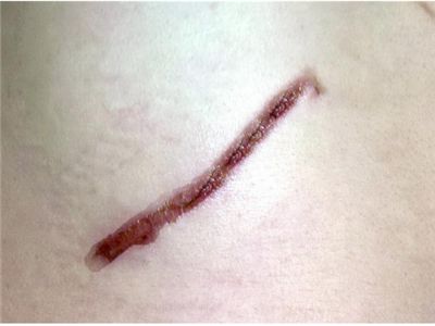 顏丙燕整容傳聞曝光，揭秘其真相及影響