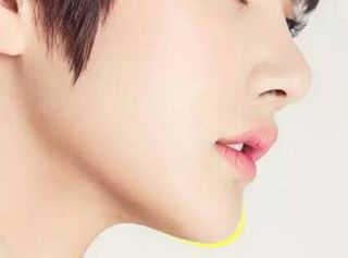 長沙激光祛痘哪家醫(yī)院效果好，怎樣選擇適合自己的治療機(jī)構(gòu)？