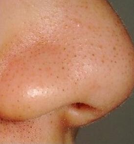 蘇州紫馨醫(yī)療整形美容醫(yī)院真的靠譜嗎？醫(yī)院簡介和醫(yī)生資料全知道！