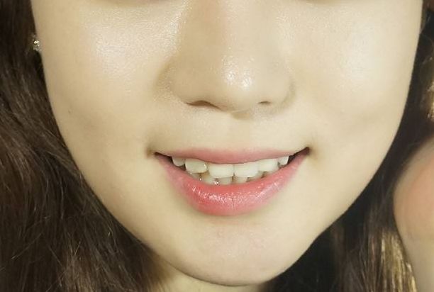 上海激光祛痣最好的醫(yī)院有哪些？