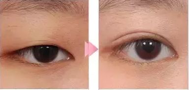 武漢哪家醫(yī)院做吸脂好？選擇正規(guī)醫(yī)院，打造完美身材！