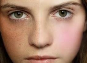 上海體表腫塊怎么辦？哪家醫(yī)院是專業(yè)醫(yī)治的？