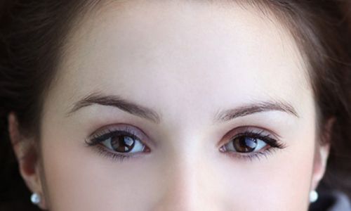 蘇州哪家醫(yī)院的光子嫩膚效果最好？