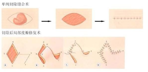 鄭州第三人民醫(yī)院整形科口碑如何？有哪些口碑醫(yī)生值得推薦？費(fèi)用情況如何？
