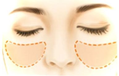 北京取膨體哪家醫(yī)院好？看看這些專家推薦的權(quán)威醫(yī)院排行榜