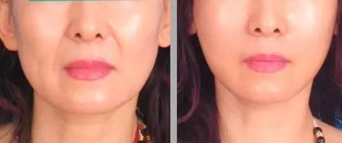 你想知道假體豐胸的效果和優(yōu)勢(shì)嗎？安全可靠的方式實(shí)現(xiàn)完美改變！