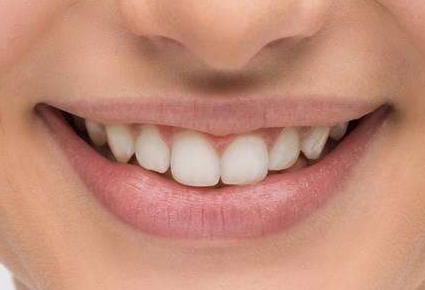 微創(chuàng)改臉型手術(shù)的費用如何計算？術(shù)后護理方法有哪些？