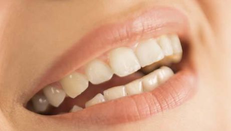 北京豐下巴哪家醫(yī)院好？為您推薦最權(quán)威的北京下巴整形醫(yī)院排行榜