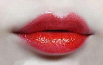 南寧疤痕治療哪家醫(yī)院靠譜，口碑好？