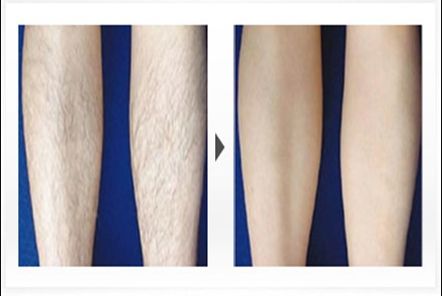 上海哪家微整醫(yī)院好又正規(guī)？排名與口碑揭秘