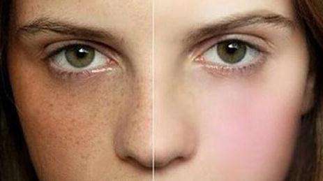 北京協(xié)和醫(yī)院整形外科到底有何過人之處？