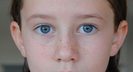 杭州除疤醫(yī)院哪家好？專業(yè)解決疤痕問題的推薦！